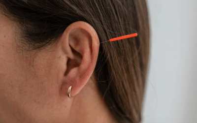 What Is Ear Acupuncture? A Holistic Approach to Healing Anxiety and Pain